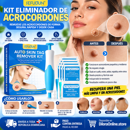 🌟 Kit Removedor de Verrugas y Acrocordones 💧✨